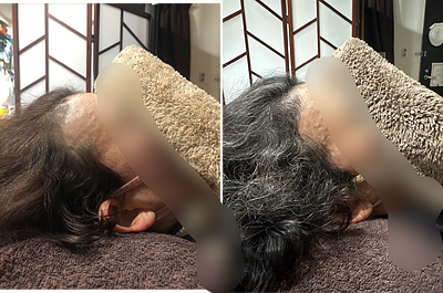 施術経過スタイル