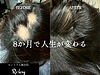 ツボクサ（CICA）化粧水は育毛に良い？