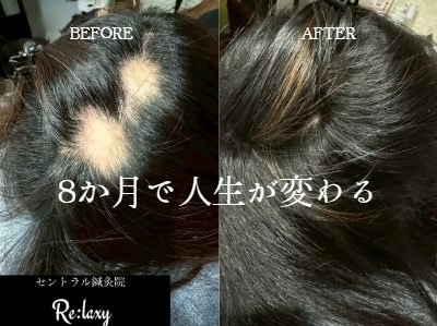 8ヶ月で変わる 8ヶ月で変わる