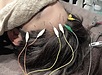 私が育毛鍼セミナーを開催する理由