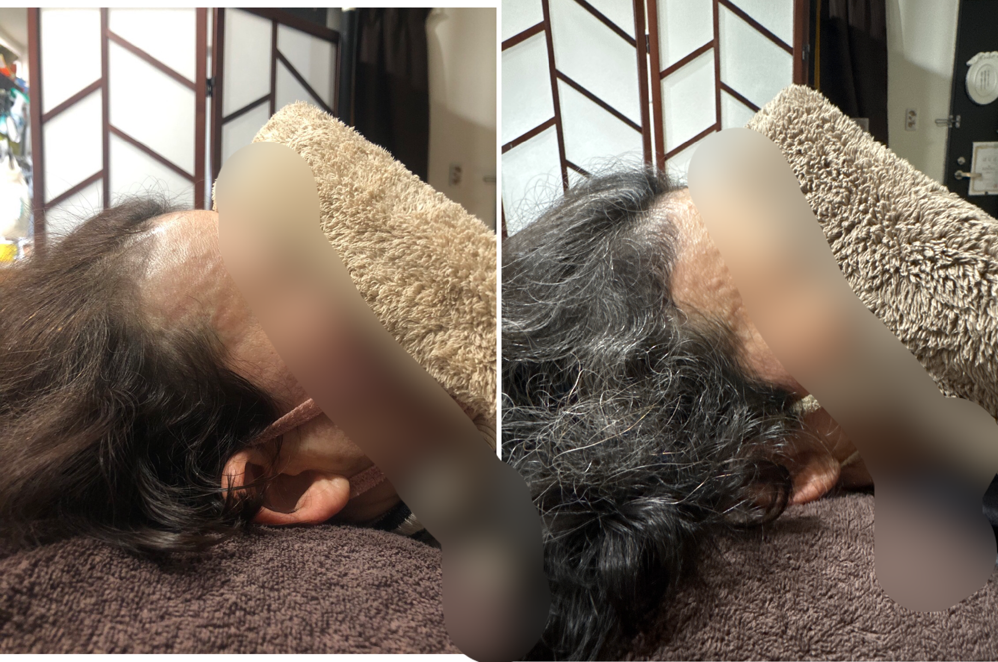 W様2年半経過後も変化がとても良いです。