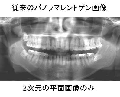 従来のレントゲン