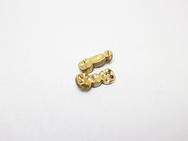 金歯9.9g