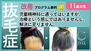 抜毛症改善事例　11歳女性初回カウンセリングの時にここなら治るかも？と思えた