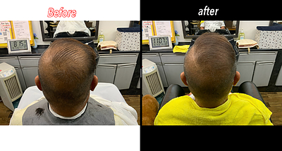 シンサイ刈り諦めてませんか？エクステ増毛とシンサイ刈りのコラボ