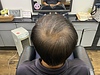 つむじの透け感が気になる方へ｜増毛エクステで自然なボリューム感に