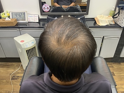 つむじの透け感が気になる方へ｜増毛エクステで自然なボリューム感に