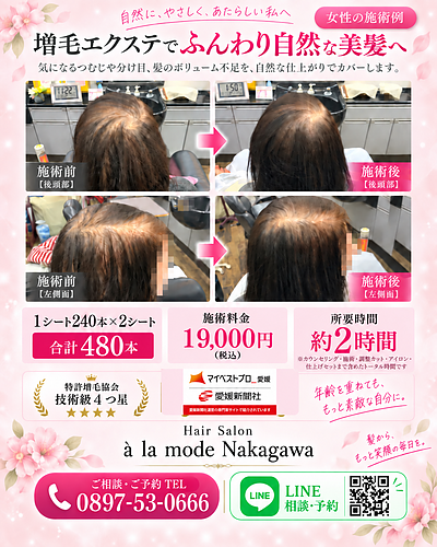 女性のつむじ・分け目のボリューム不足に｜増毛エクステ480本の施術例【愛媛県　西条市】