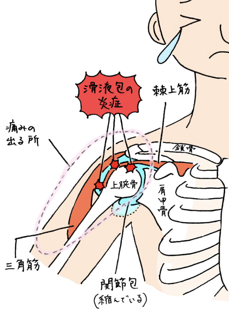 四十肩五十肩・肩関節周囲炎