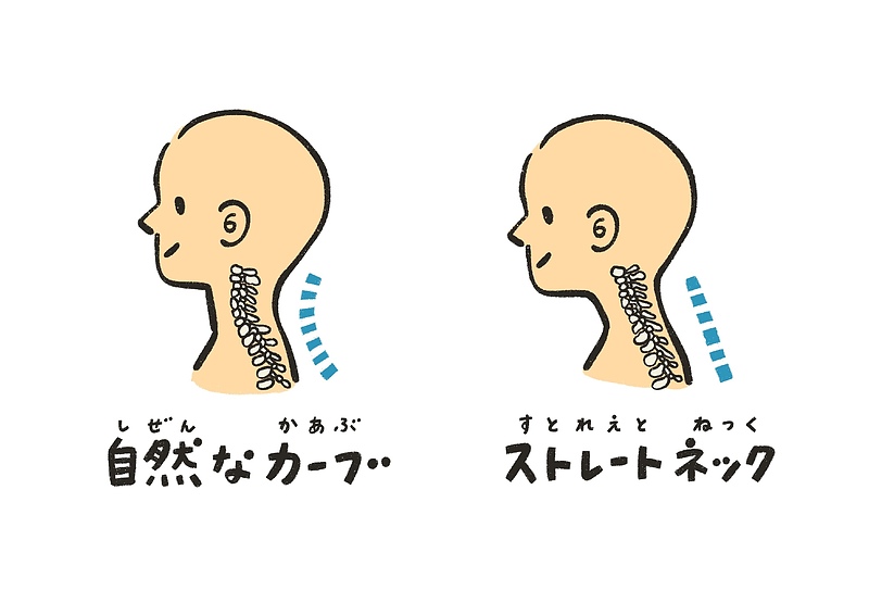 ストレートネック