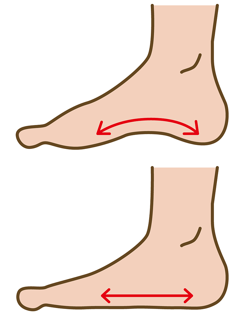 偏平足　イラスト