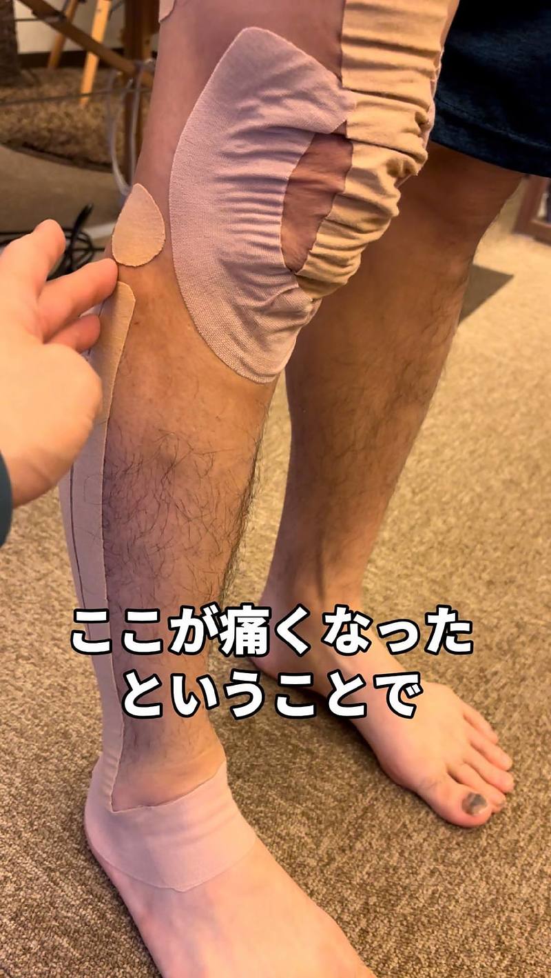 長腓骨筋の痛み写真