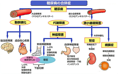 糖尿病を遠ざけるにはショウガが最も効果的！