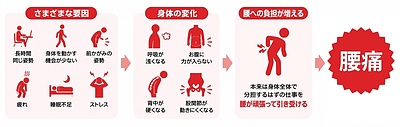 腰痛の原因は「腰」だけじゃない？僕が2度の入院から学んだ腰痛との向き合い方