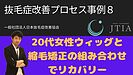 抜毛症改善プロセス事例8－20代女性ウィッグと縮毛矯正の組み合わせでリカバリー