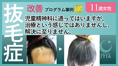 ★抜毛症改善事例100：11歳女性：初回カウンセリングの時にここなら治るかも？と思えた。
