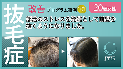 ★抜毛症改善事例101：20歳女性：部活のストレスを発端として前髪を抜くようになりました。