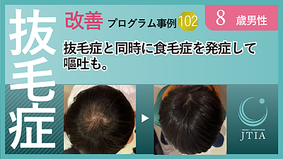 ★抜毛症改善プロセス事例102：8歳男児：抜毛症と同時に食毛症を発症して嘔吐も