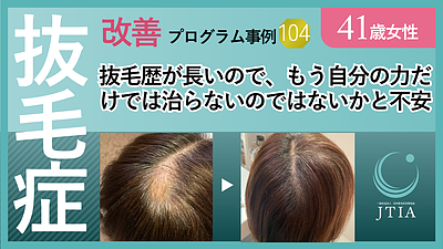 ★抜毛症改善事例104：41歳女性：抜毛歴が長いので、もう自分の力だけでは治らないのではないかと不安