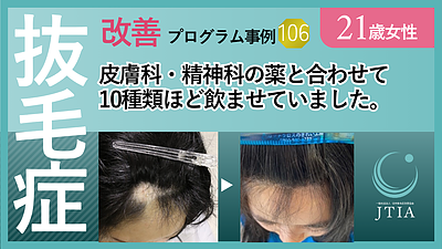 21歳女性：軽度発達障害があり精神科と皮膚科へも行き発毛に良いと色々サプリと薬を紹介されて・・・