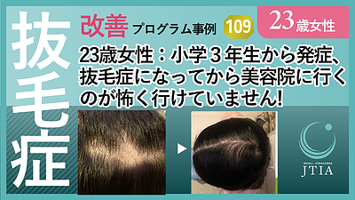 ★抜毛症改善事例109：23歳女性：小学3年生から発症、抜毛症になり美容院に行くのが怖く・・・