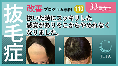 ★抜毛症改善事例110：33歳女性：抜いた時にスッキリした感覚がありそこからやめれなくなりました。
