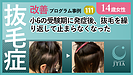★抜毛症改善事例111:16歳女性:小6の受験期に発症。少し治まったり、激しくなったりを繰り返し・・・
