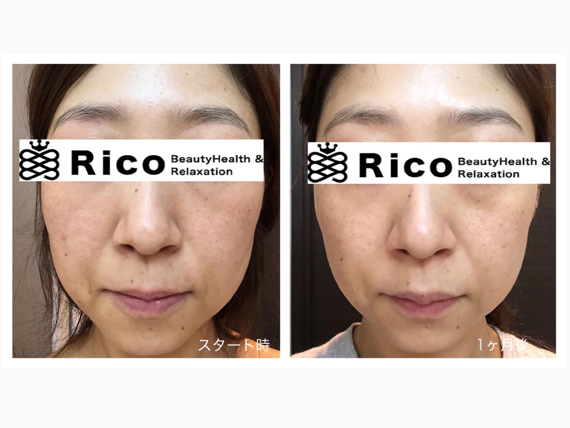 40代スキンケアでの変化。