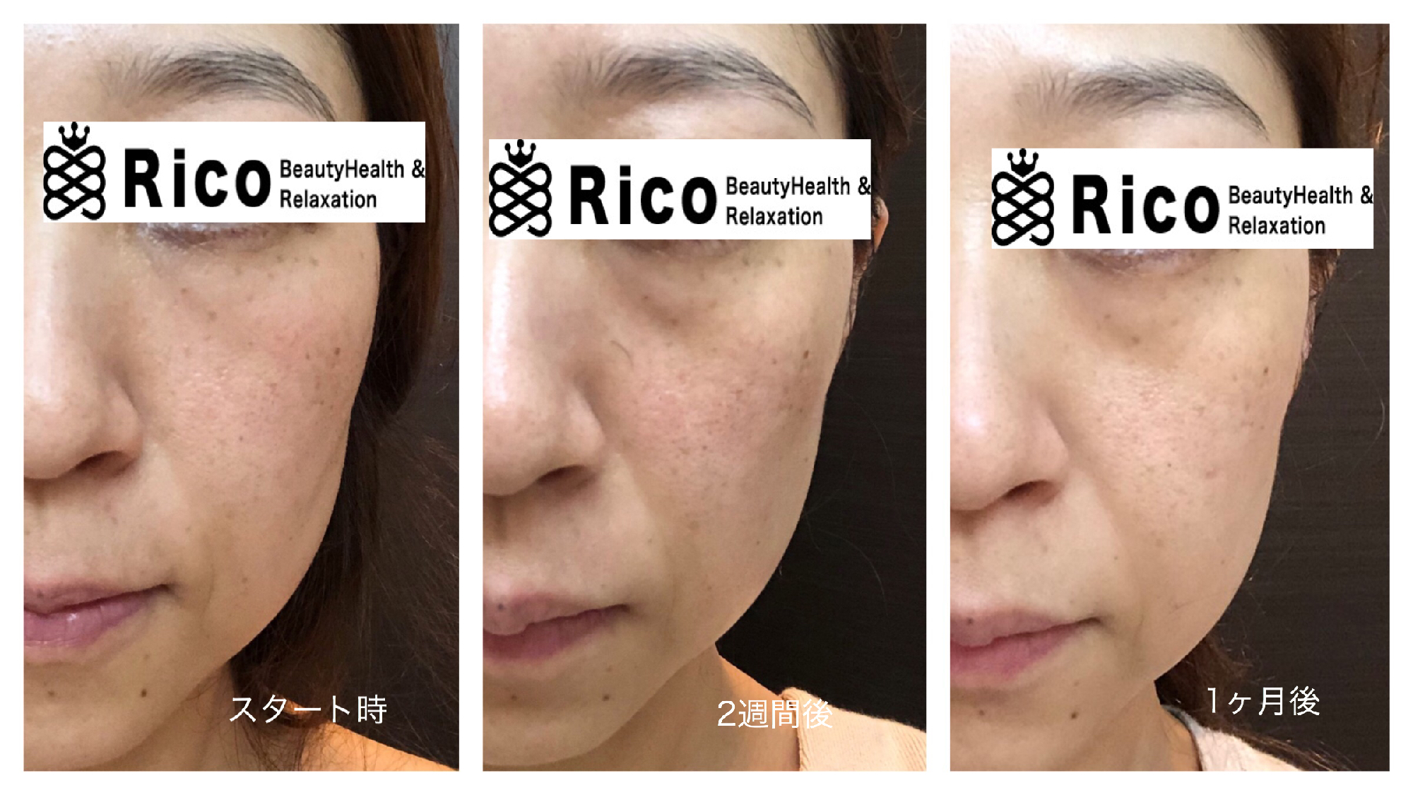 40代スキンケアでの変化。