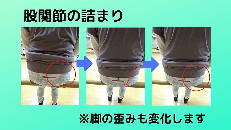 股関節の詰まりを自分で治す