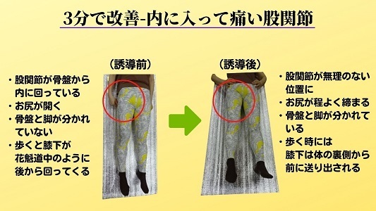 3分で改善　内に入って痛い股関節