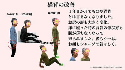 猫背が治るとお顔まで若々しくなります