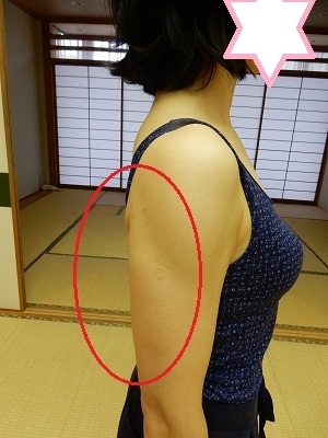 二の腕が太く見えるんです ダンスインストラクター うまさきせつこ マイベストプロ神戸