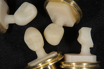 ＜患者さんからの質問＞銀色の金属の詰め物ってホントに良くないの？＜一般歯科治療・歯科材料＞（つくば/土浦　審美歯科）