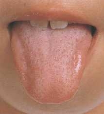 健康な舌