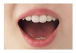 ＜医学博士が教える口臭ケア＞歯科医学的アプローチで行う口臭治療