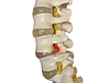 その痛み、椎間板ヘルニアのせい？痛み止めでよくならない坐骨神経痛、実は筋・筋膜痛かも！？