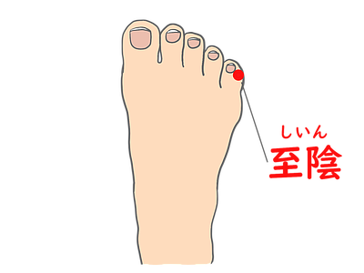 逆子（骨盤位）と鍼灸治療 ～おなかの赤ちゃんにやさしい自然の力～