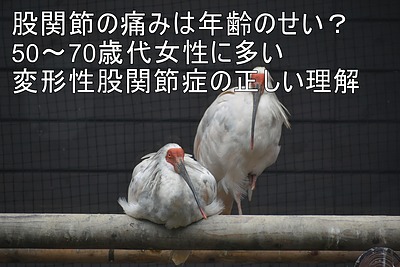 股関節の痛みは年齢のせい？|50〜70歳代女性に多い変形性股関節症の正しい理解