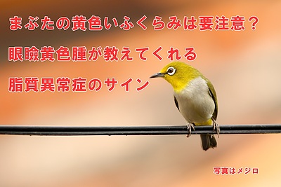 まぶたの黄色いふくらみは危険信号？眼瞼黄色腫が教えてくれる動脈硬化のサイン
