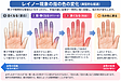寒いと指が真っ白になるのはなぜ？レイノー現象とは｜しもやけとの違い・原因・鍼灸・自宅でできる対策