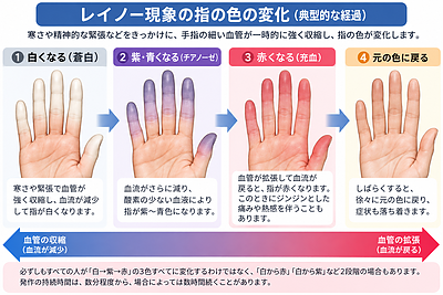 寒いと指が真っ白になるのはなぜ？レイノー現象とは｜しもやけとの違い・原因・鍼灸・自宅でできる対策