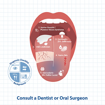 舌の痛みの全体像