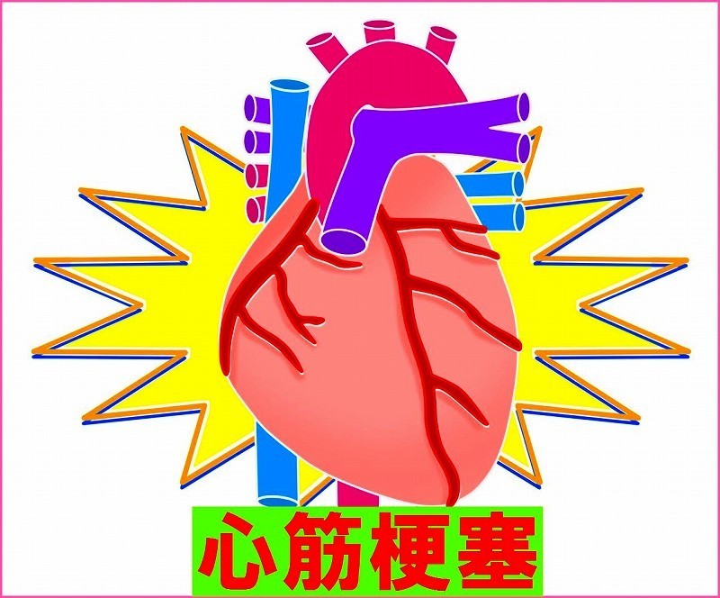 冠元顆粒　心筋梗塞