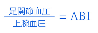 ABI(足関節上腕血圧比)