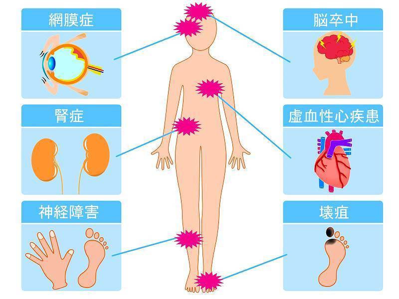 糖尿病　若蘇源