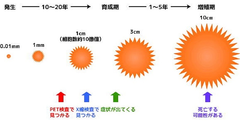 ガン