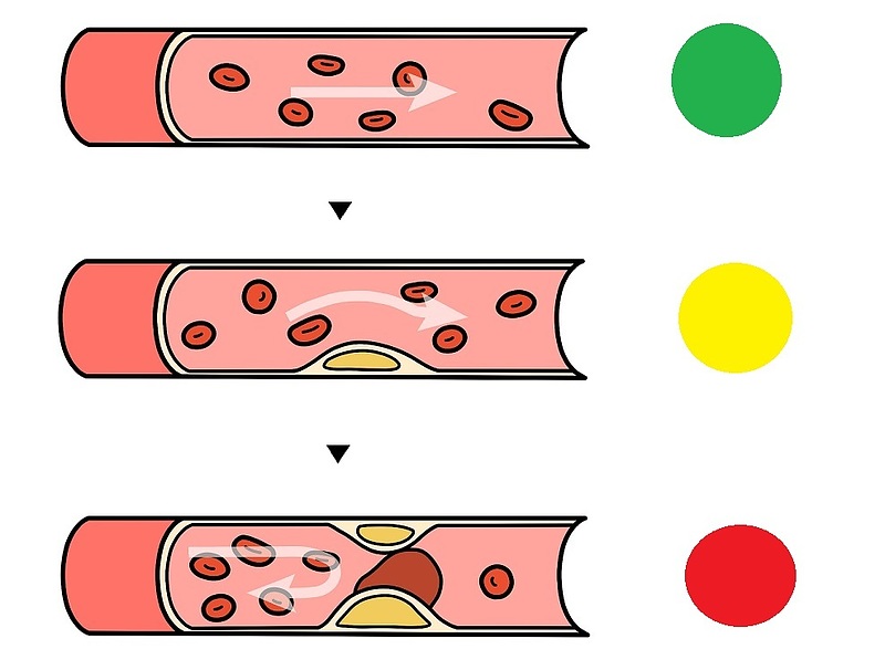 冠元顆粒　五浄心