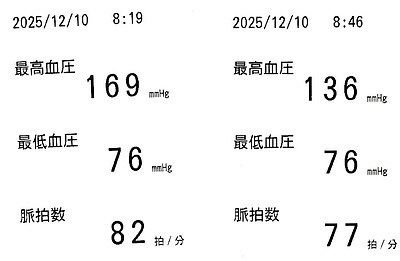 《正しい血圧管理》
