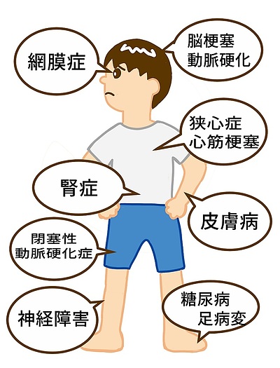 《糖尿病の方の骨粗鬆症縦策》